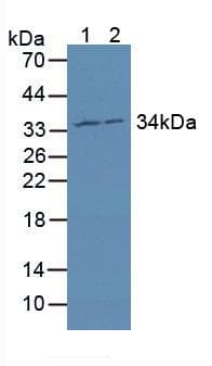 BM022 / MRPL1 Antibody (aa147-285)