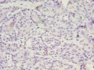 OVCA1 / DPH1 Antibody (aa192-318)