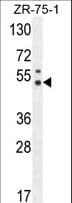 PUS3 Antibody (aa35-64)