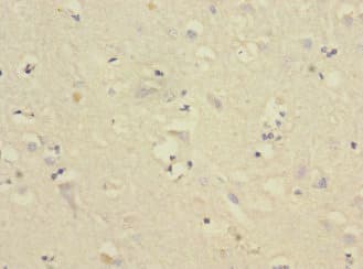 Polyclonal Rabbit anti-Human CNTN4 Antibody (IHC)