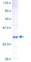 Human HMGN4 Protein (Recombinant GST)