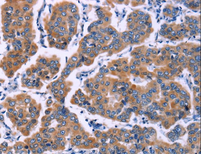ZEB2 / SIP-1 Antibody