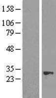 NUDT21 Protein (Over-Expression Lysate Myc-DDK (Flag))