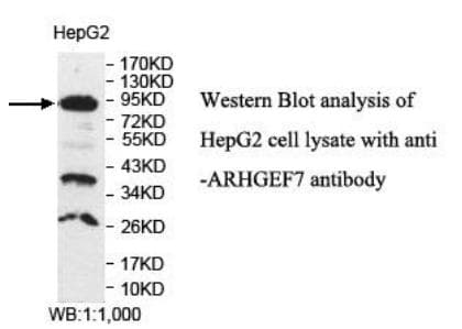 ARHGEF7 Antibody (aa246-450)