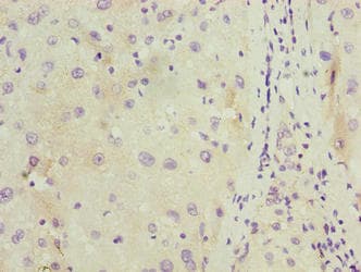 Polyclonal Rabbit anti-Human C11orf53 Antibody (IHC, WB)