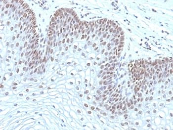MAP3K1 / MEKK1 Antibody (aa1211-1310, clone 2F6)