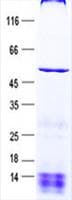 Human AP3M1 Protein (Recombinant His, N-Terminal)