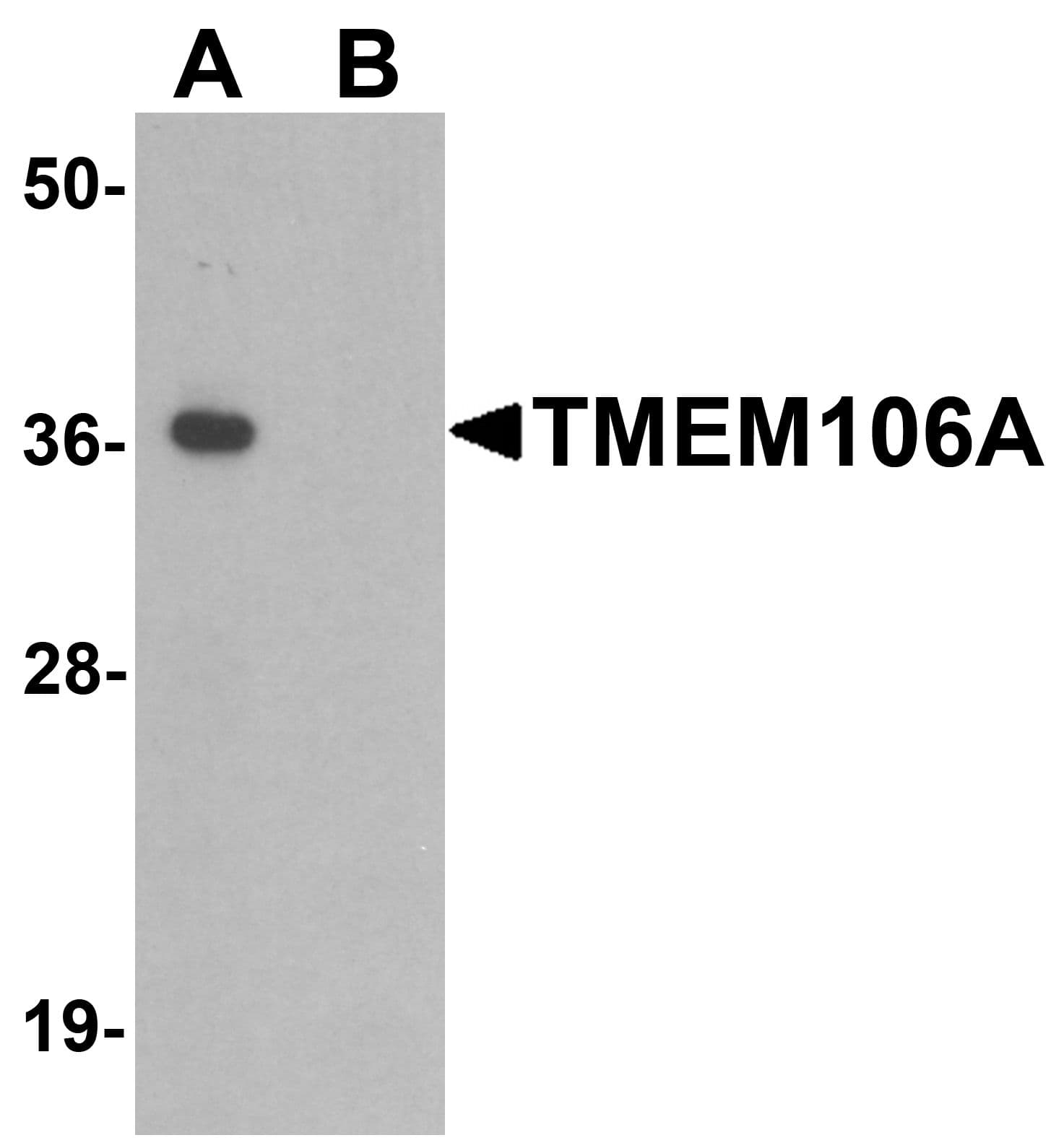 IHC-plus™ TMEM106A Antibody
