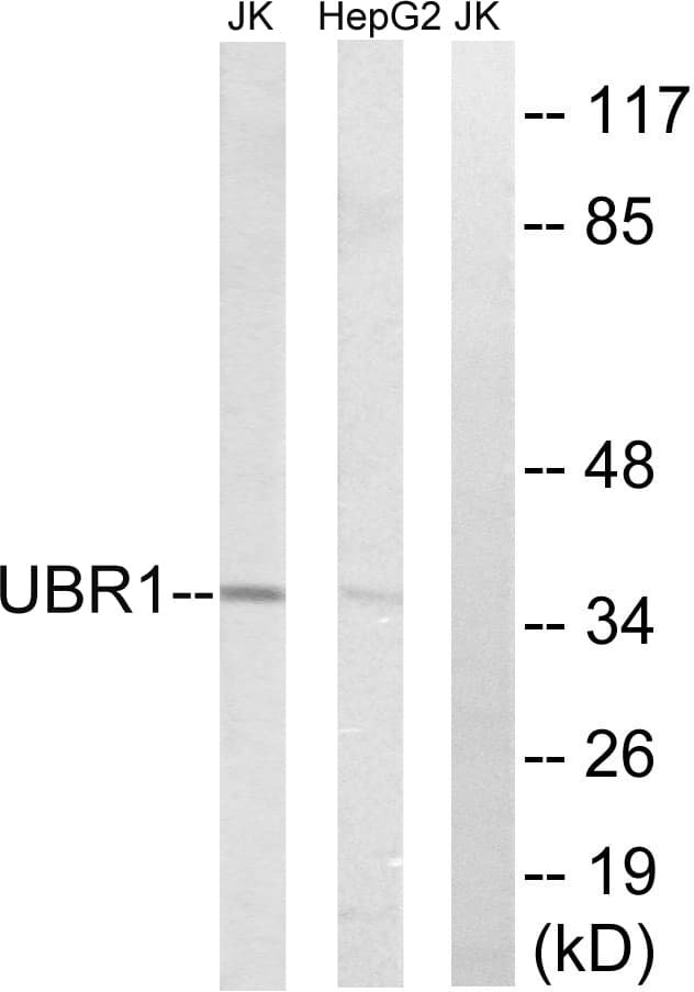 UBR1 Antibody (aa821-870)