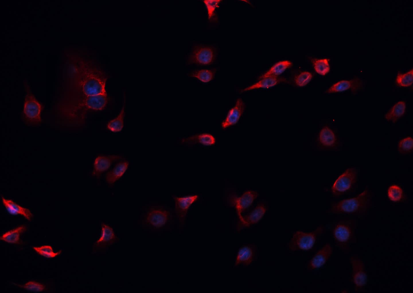 Endostatin Antibody