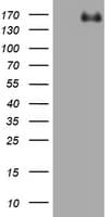ZEB1 / AREB6 Antibody (aa1-350, clone OTI4B8)