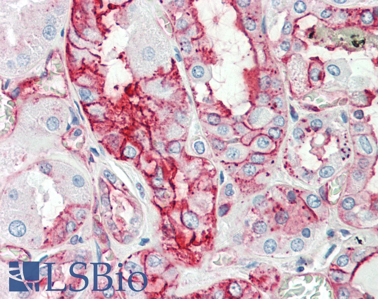 IHC-plus™ ANXA2 / Annexin A2 Antibody (aa121-141)