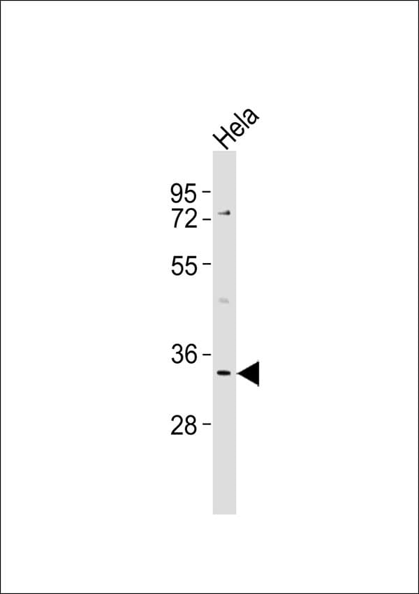 KIR2DS5 Antibody