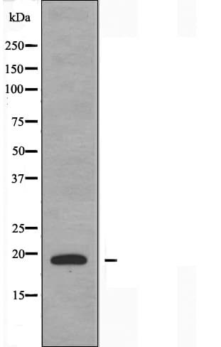 TNFSF15 / TL1A / VEGI Antibody