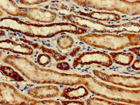 Polyclonal Rabbit anti-Human SNCAIP / Synphilin 1 Antibody (IHC, IF)