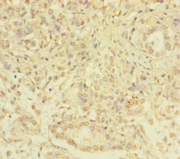 SERPINB6 / PI-6 Antibody