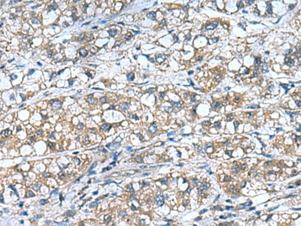 Polyclonal Rabbit anti-Human COMMD9 Antibody (IHC)