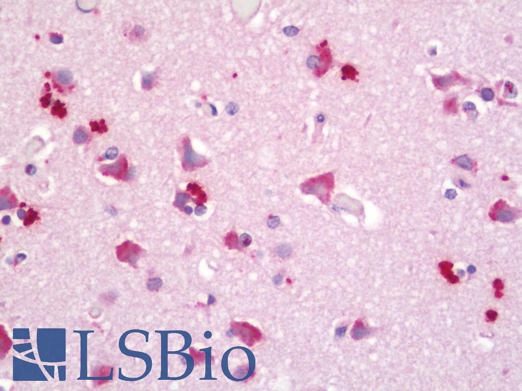 IHC-plus™ KCNC4 / Kv3.4 Antibody (aa1-50)