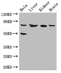 Polyclonal Rabbit anti-Human KBTBD6 Antibody (IHC, IF, WB)
