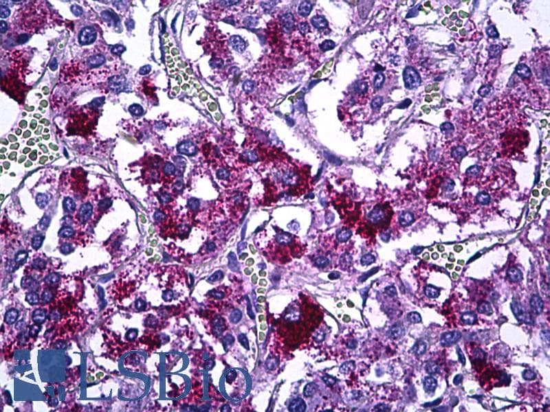 IHC-plus™ IRS1 Antibody (aa289-338)