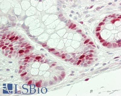 IHC-plus™ KPNA2 / Importin Alpha 1 Antibody (aa475-C-term)