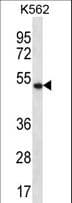 APOBEC3G / CEM15 Antibody (aa231-260)