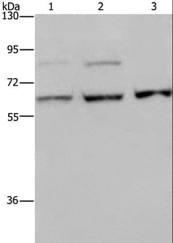 Polyclonal Rabbit anti-Human KIF22 / OBP Antibody (IHC, WB)