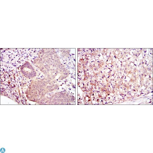 MAP2K6 / MEK6 / MKK6 Antibody