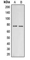 Polyclonal Rabbit anti-Human Endostatin Antibody (C-Terminus, IHC, WB)