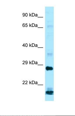 IFNA16 / Interferon Alpha 16 Antibody (C-Terminus)