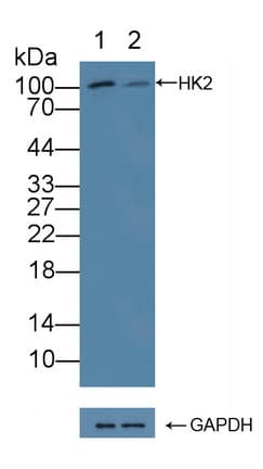 HK2 / Hexokinase 2 Antibody (aa469-669)