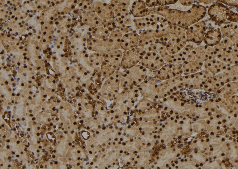 HIST1H1E Antibody (phospho-Thr17)