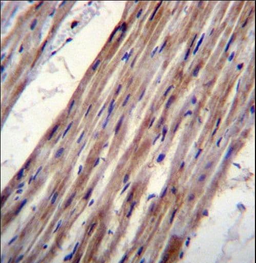 KCNJ8 / Kir6.1 Antibody (aa4-33)