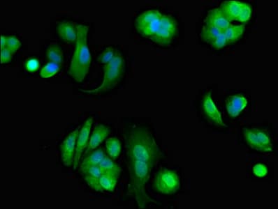 EIF4ENIF1 / 4E-T Antibody