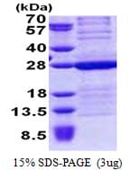 Human HMGB3 Protein (Recombinant His)
