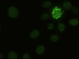 NOTCH1 Antibody (clone OTI3E12)