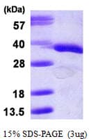 Human GNB2L1 / RACK1 Protein (Recombinant His)
