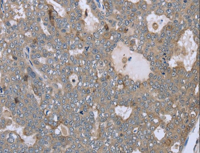 Polyclonal Rabbit anti-Human FAR2 Antibody (IHC)