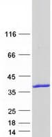 Human SULT1A2 / Sulfotransferase 1A2 Protein (Recombinant Myc-DDK (Flag))