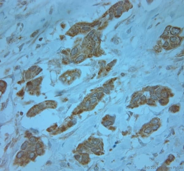 KCNJ13 / KIR7.1 Antibody (aa2-50)