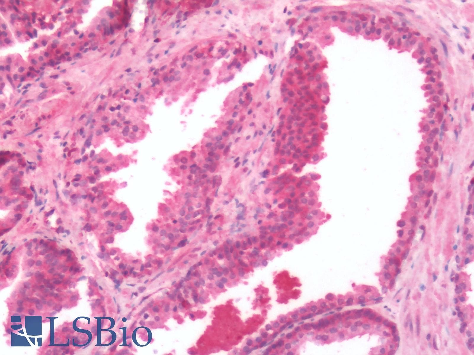 PathPlus™ LPAR2 / EDG4 Antibody (Cytoplasmic Domain)