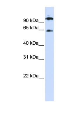 RUNX1T1 / ETO Antibody (aa288-337)