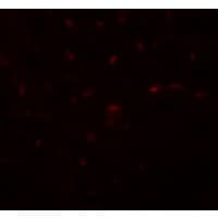 IHC-plus™ TRB3 / TRIB3 Antibody