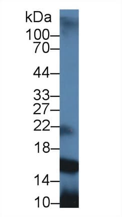 PIP / GCDFP-15 Antibody (aa41-139)