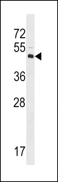 IHC-plus™ Polyclonal Rabbit anti-Human LYVE1 Antibody (aa46-77, IHC, WB)