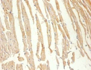 Polyclonal Rabbit anti-Human CKM / Creatine Kinase MM Antibody (IHC, WB)