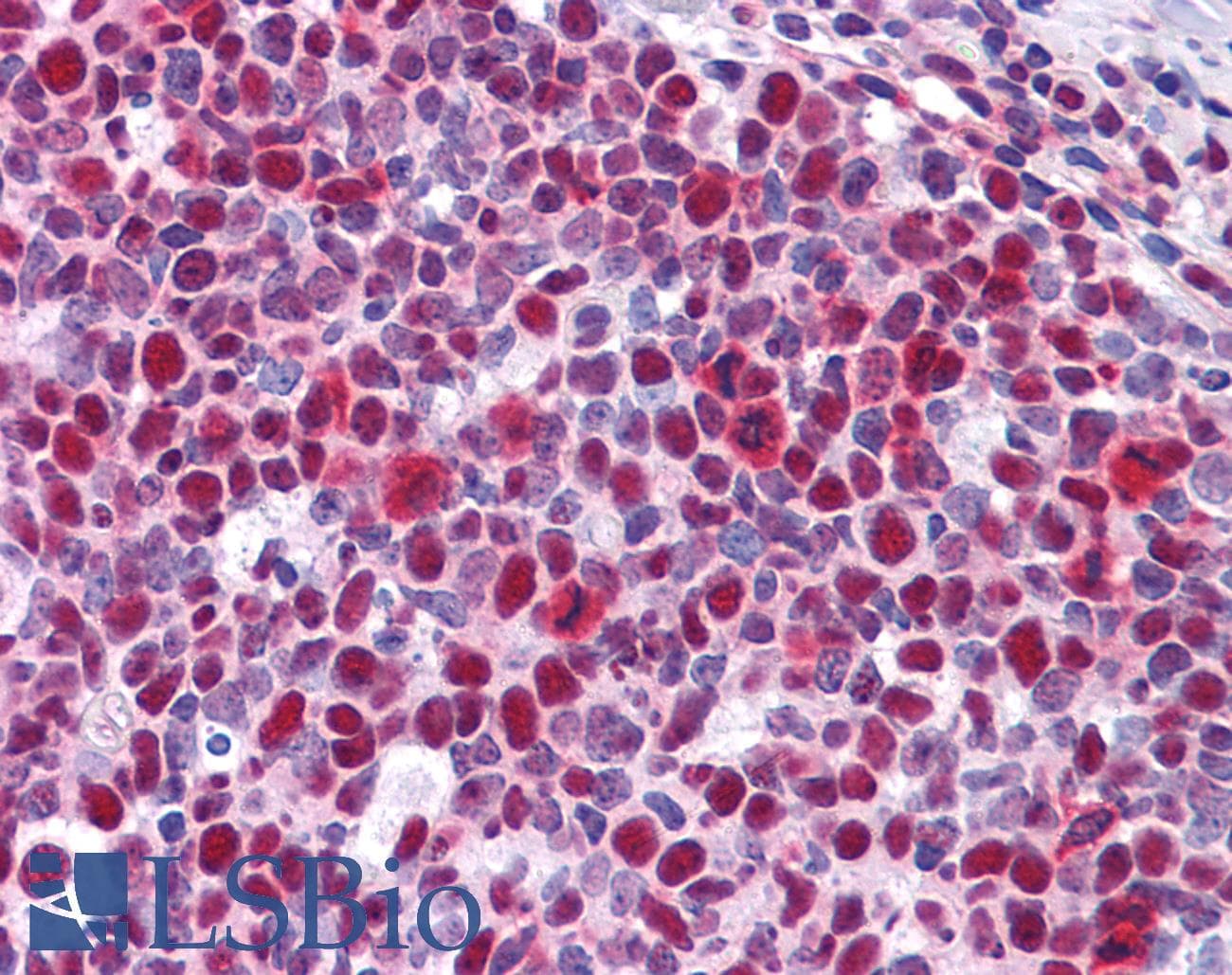 IHC-plus™ HMG1 / HMGB1 Antibody (clone 2F6)