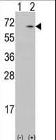 CAMKK1 Antibody (aa86-121)