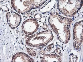 ALS2CR1 / NIF3L1 Antibody (clone OTI4B5)