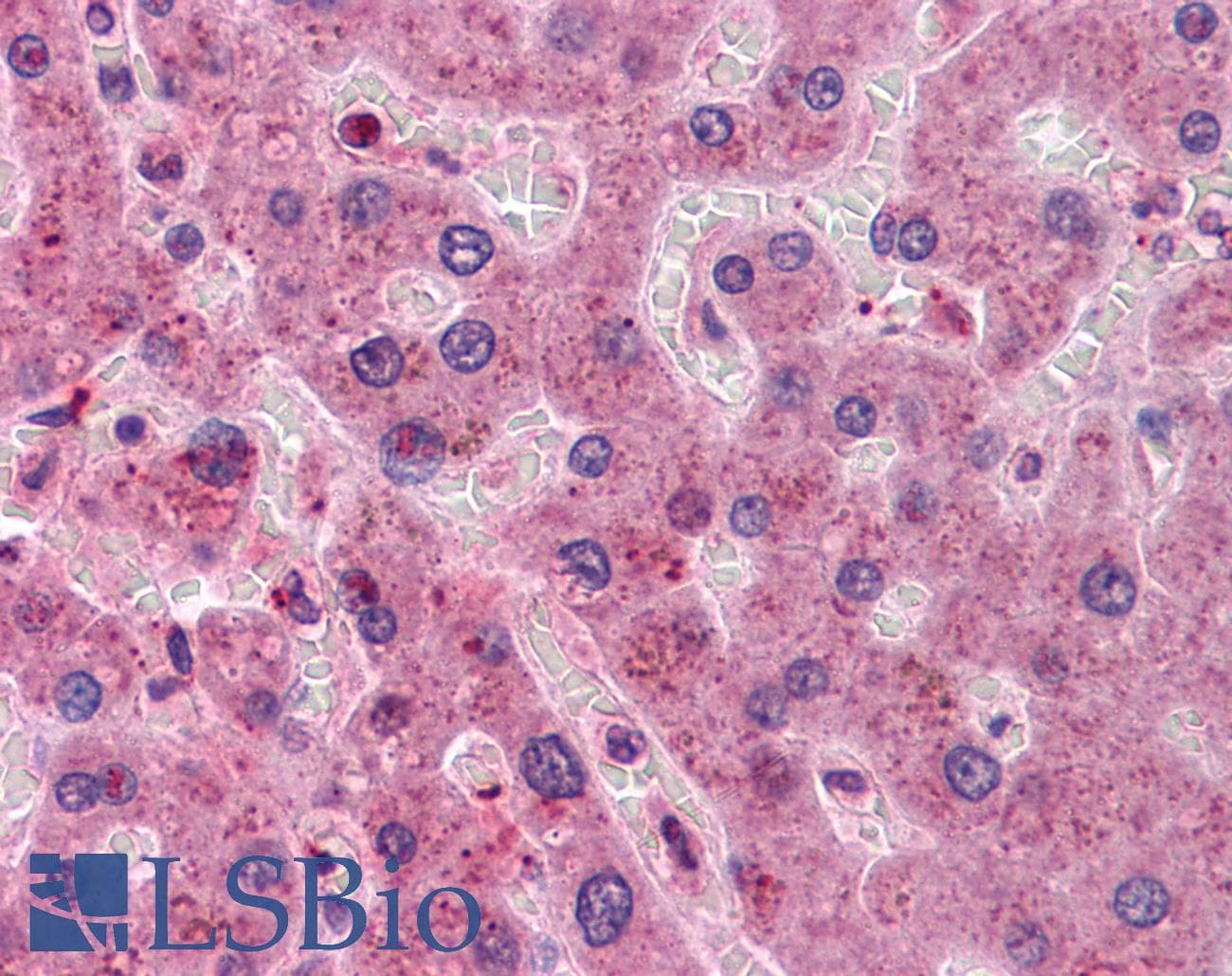 IHC-plus™ HT036 / HYI Antibody (clone 2A2)
